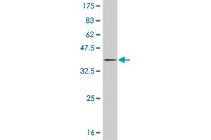 Western Blot detection against Immunogen (35. (JAG2 Antikörper  (AA 121-210))