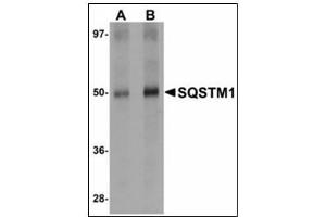 Western blot analysis of SQSTM1 in Human spleen tissue lysate with SQSTM1 antibody at (A) 1 and (B) 2 µg/ml. (SQSTM1 Antikörper  (C-Term))