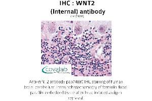 Image no. 1 for anti-Wingless-Type MMTV Integration Site Family Member 2 (WNT2) (Internal Region) antibody (ABIN1740825) (WNT2 Antikörper  (Internal Region))
