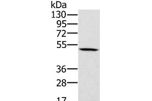 Western Blot analysis of 231 cell using PSMC2 Polyclonal Antibody at dilution of 1:500 (PSMC2 Antikörper)