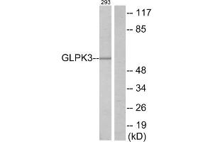 Western blot analysis of extracts from 293 cells, using GLPK3 antibody. (Glycerol Kinase Antikörper  (N-Term))