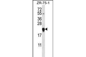 GAGE12H Antibody (N-term) (ABIN657560 and ABIN2846567) western blot analysis in ZR-75-1 cell line lysates (35 μg/lane). (G Antigen 12H Antikörper  (N-Term))