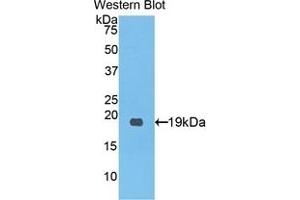 Detection of Recombinant PCPE1, Human using Polyclonal Antibody to Procollagen C-Endopeptidase Enhancer (PCOLCE)