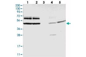 Western blot analysis of Lane 1: RT-4, Lane 2: U-251 MG, Lane 3: Human Plasma, Lane 4: Liver, Lane 5: Tonsil with G3BP2 polyclonal antibody  at 1:250-1:500 dilution. (G3BP2 Antikörper)