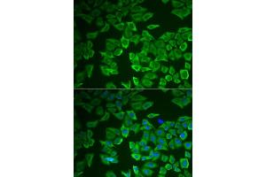 Immunofluorescence analysis of HeLa cells using CRHBP antibody (ABIN6129571, ABIN6139030, ABIN6139033 and ABIN6222243). (CRHBP Antikörper  (AA 25-322))