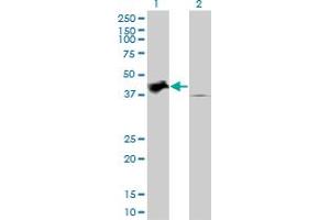Western Blotting (WB) image for anti-Tribbles Pseudokinase 2 (TRIB2) (AA 254-344) antibody (ABIN599226) (TRIB2 Antikörper  (AA 254-344))