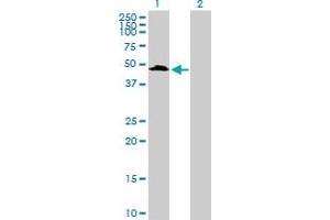 Western Blot analysis of UIMC1 expression in transfected 293T cell line by UIMC1 MaxPab polyclonal antibody. (UIMC1 Antikörper  (AA 1-385))