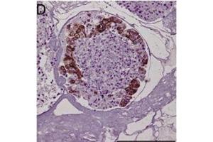 Immunohistochemistry (IHC) image for anti-Keratin 20 (KRT20) antibody (ABIN2856768)