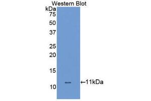 Western Blotting (WB) image for anti-Solute Carrier Family 6 (Neurotransmitter Transporter, Dopamine), Member 3 (SLC6A3) (AA 562-619) antibody (ABIN1867519) (SLC6A3 Antikörper  (AA 562-619))