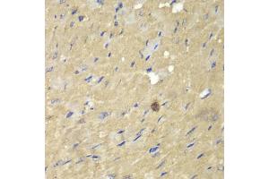 Immunohistochemistry of paraffin-embedded mouse heart using AKR7A2 antibody (ABIN5970569) at dilution of 1/100 (40x lens). (AKR7A2 Antikörper)