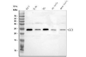 Western blot analysis of Grancalcin/GCA using anti-Grancalcin/GCA antibody (ABIN6719568).