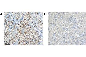Immunohistochemistry (IHC) image for anti-Complement C1q Tumor Necrosis Factor-Related Protein 6 (C1QTNF6) (Globular Domain), (Globular Domain-less) antibody (ABIN1169274)