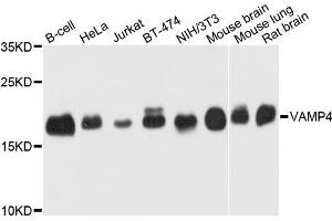 Western blot analysis of extract of various cells, using VAMP4 antibody.