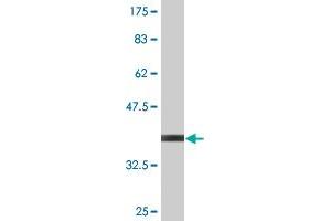 Western Blot detection against Immunogen (35. (UBE2B Antikörper  (AA 63-152))