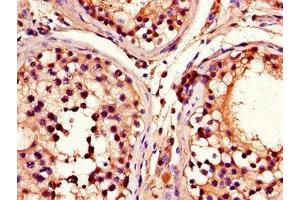 Immunohistochemistry of paraffin-embedded human testis tissue using ABIN7164909 at dilution of 1:100 (ADRM1 Antikörper  (AA 2-407))
