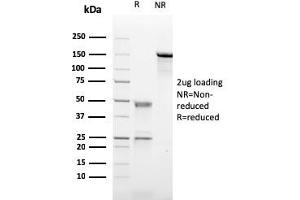 SDS-PAGE Analysis Purified CD21-Monospecific Mouse Monoclonal Antibody (CR2/2754). (CD21 Antikörper  (AA 142-240))