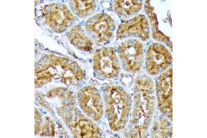 Immunohistochemistry of paraffin-embedded rat kidney using  Rabbit mAb (ABIN7265369) at dilution of 1:100 (40x lens). (Acetyl-CoA Carboxylase alpha Antikörper)