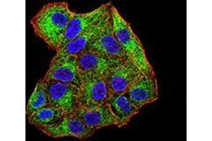Immunofluorescence analysis of Hela cells using SYK mouse mAb (green). (SYK Antikörper  (AA 217-356))