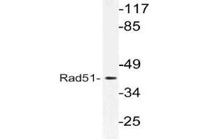 Western blot (WB) analysis of Rad51 antibody in extracts from LOVO cells. (RAD51 Antikörper)