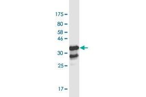 Western Blot detection against Immunogen (37. (ZBTB7B Antikörper  (AA 433-537))