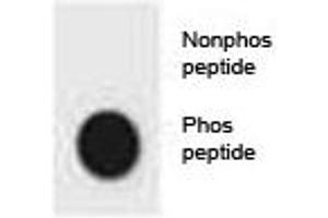 Dot blot analysis of phospho-CDKN2A antibody. (CDKN2A Antikörper  (pSer8))