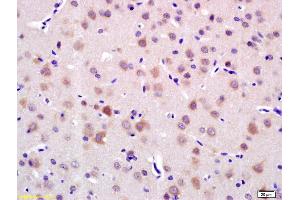 Formalin-fixed and paraffin embedded rat brain labeled with Anti-LRIG1 Polyclonal Antibody, Unconjugated (ABIN735263) at 1:200 followed by conjugation to the secondary antibody and DAB staining. (Lrig1 Antikörper  (AA 1001-1093))