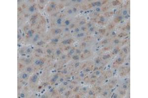 IHC-P analysis of Human Tissue, with DAB staining. (GBA Antikörper  (AA 334-498))