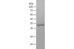 Western Blotting (WB) image for Sulfotransferase Family, Cytosolic, 2A, Dehydroepiandrosterone (DHEA)-Preferring, Member 1 (SULT2A1) (AA 200-285) protein (His-IF2DI Tag) (ABIN7282838) (SULT2A1 Protein (AA 200-285) (His-IF2DI Tag))