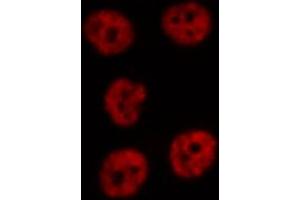 ABIN6274751 staining Hela cells by IF/ICC. (RPS19 Antikörper  (Internal Region))