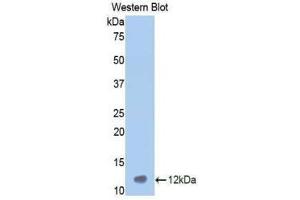 Western Blotting (WB) image for anti-Vitronectin (VTN) (AA 400-468) antibody (ABIN1860949) (Vitronectin Antikörper  (AA 400-468))