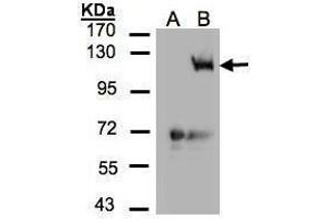 WB Image Western Blot analysis of PIK3CG expression in transfected 293T cell line by PIK3CG polyclonal antibody. (PIK3 gamma Antikörper  (C-Term))