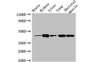Western Blot Positive WB detected in: Mouse brain tissue, Mouse kidney tissue, Mouse liver tissue, Rat lung tissue, Rat skeletal muscle tissue All lanes: P2RX4 antibody at 3 μg/mL Secondary Goat polyclonal to rabbit IgG at 1/50000 dilution Predicted band size: 44, 46, 41 kDa Observed band size: 44 kDa (P2RX4 Antikörper  (AA 91-176))