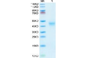 Mouse CD52 on Tris-Bis PAGE under reduced conditions. (CD52 Protein (CD52) (AA 24-47) (Fc Tag))