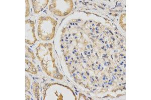 Immunohistochemistry (IHC) image for anti-Propionyl CoA Carboxylase beta Polypeptide (PCCB) antibody (ABIN1876603) (PCCB Antikörper)