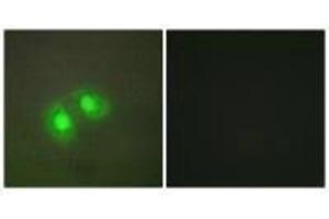 Immunofluorescence analysis of A549 cells, using TOP2A antibody. (Topoisomerase II alpha Antikörper  (N-Term))