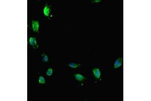 Immunofluorescent analysis of Hela cells using ABIN7172767 at dilution of 1:100 and Alexa Fluor 488-congugated AffiniPure Goat Anti-Rabbit IgG(H+L) (ATRX Antikörper  (AA 2161-2443))