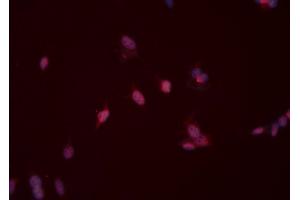 ABIN6276526 staining HeLa cells by ICC/IF. (MSH2 Antikörper  (C-Term))