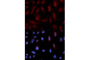 Immunofluorescence analysis of U2OS cell using PLCB1 antibody. (Phospholipase C beta 1 Antikörper  (AA 917-1216))