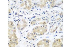 Immunohistochemistry of paraffin-embedded Human stomach using EIF3A Polyclonal Antibody at dilution of 1:100 (40x lens). (EIF3A Antikörper)