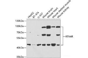 Western blot analysis of extracts of various cell lines using RTN4R Polyclonal Antibody at dilution of 1:1000. (RTN4R Antikörper)