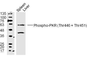 Mouse spleen and liver lysates probed with PKR(Thr446+Thr451) Polyclonal Antibody, unconjugated  at 1:300 overnight at 4°C followed by a conjugated secondary antibody at 1:10000 for 90 minutes at 37°C. (EIF2AK2 Antikörper  (pThr446, pThr451))