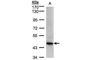 WB Image Sample(30 μg of whole cell lysate) A:H1299 7. (ZBTB24 Antikörper  (C-Term))
