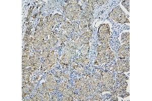IHC analysis of RPL13A using anti-RPL13A antibody (ABIN7600470).