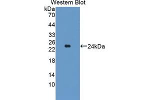 Detection of Recombinant TAK1L, Mouse using Polyclonal Antibody to TAK1 Like Protein (TAK1L) (MAP3K7CL Antikörper  (AA 1-142))