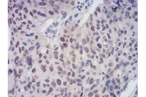 Immunohistochemistry (IHC) image for anti-Chromobox Homolog 3 (CBX3) (AA 1-183) antibody (ABIN5889677) (CBX3 Antikörper  (AA 1-183))