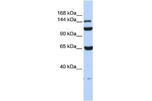 WB Suggested Anti-C17orf57 Antibody Titration: 0. (C17orf57 Antikörper  (N-Term))