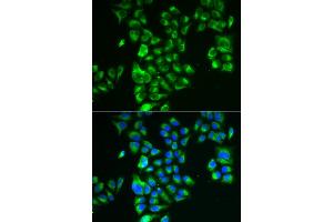 Immunofluorescence analysis of A549 cells using GLUD2 antibody (ABIN5973969). (GLUD2 Antikörper)