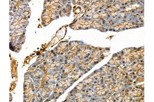 Phospho-eIF4B (Ser504) Antibody at 1/100 staining Rat muscle tissue by IHC-P. (EIF4B Antikörper  (pSer504))