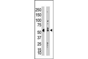 Western blot analysis of TRDMT1 polyclonal antibody  in Jurkat cell lysate (Lane A) and mouse liver tissue lysate (Lane B) . (Dnmt2 Antikörper  (AA 353-383))