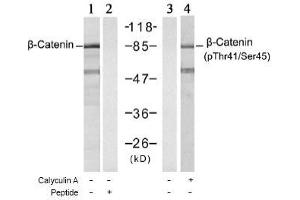 Image no. 1 for anti-Catenin (Cadherin-Associated Protein), beta 1, 88kDa (CTNNB1) (Ser45), (Thr41) antibody (ABIN197275) (CTNNB1 Antikörper  (Ser45, Thr41))